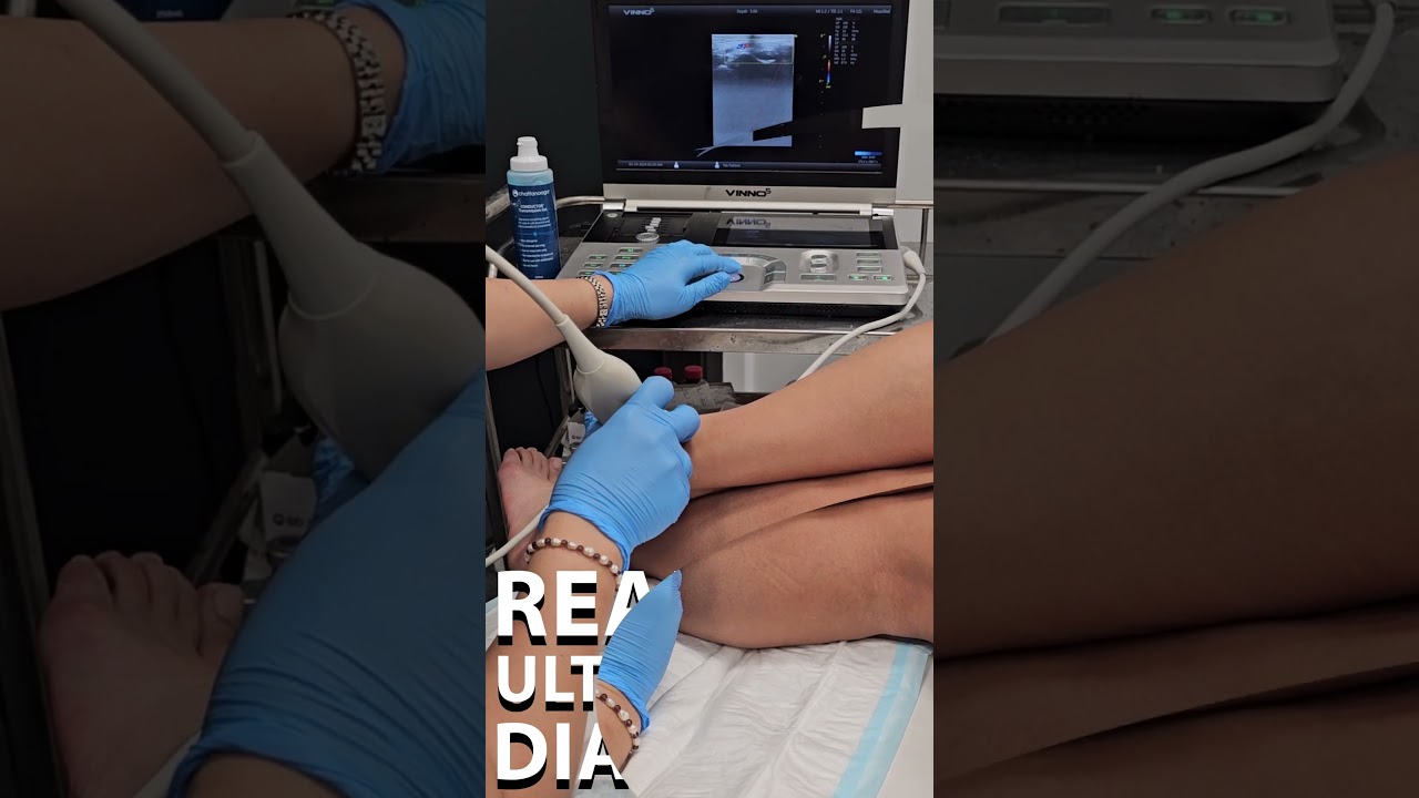 Real-time Diagnostic Ultrasound