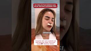 Download lagu Artis Icha Chellow setelah oplas kayak amanda manopo #ichachellow #fyp #soundhoreg #viral #trending mp3 Download lagu Artis Icha Chellow setelah oplas kayak amanda manopo #ichachellow #fyp #soundhoreg #viral #trending mp3