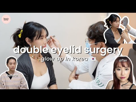 I Got Double Eyelid Surgery in Korea! Come With Me (ft. Beauty Hopper)