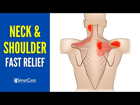 How to INSTANTLY Relieve Neck and Shoulder Pain