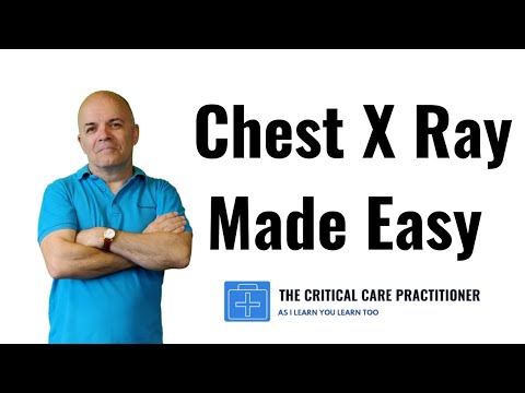 An EASY way to read the Chest X Ray!