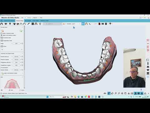 In-house Aligners and DIY solutions - Part 7