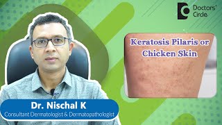 How to get rid of KERATOSIS PILARIS or CHICKEN SKIN #expertskisuno -Dr. Nischal K| Doctors