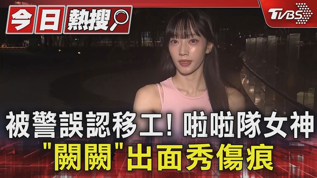 被警誤認移工 啦啦隊女神「闕闕」出面秀傷痕