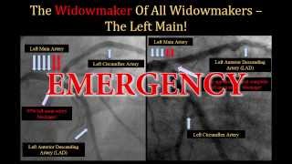 Widowmaker Heart Attack