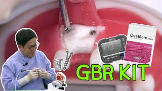 Download lagu [EASY Hands-on] GBR KIT - #11 Missing Case mp3
