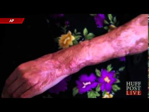 Beauty Salon Helps Acid Attack Survivors In Pakistan To Be Self