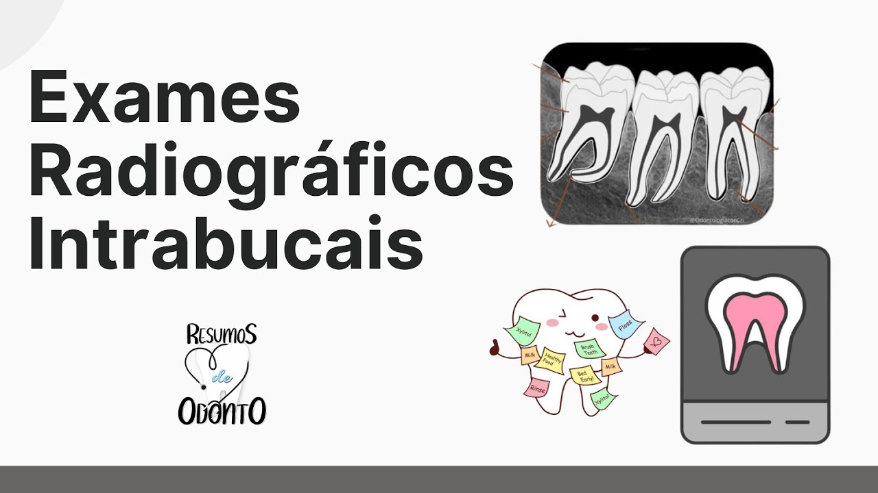 PERIAPICAL | INTERPROXIMAL | OCLUSAL - Resumos de Odonto