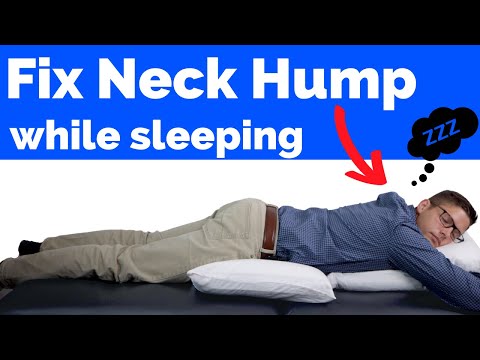 How to Fix Neck Hump While Sleeping