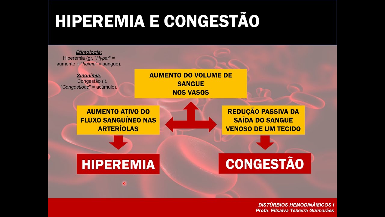 Aula - Distúrbios Hemodinâmicos I (Hiperemia e Congestão)