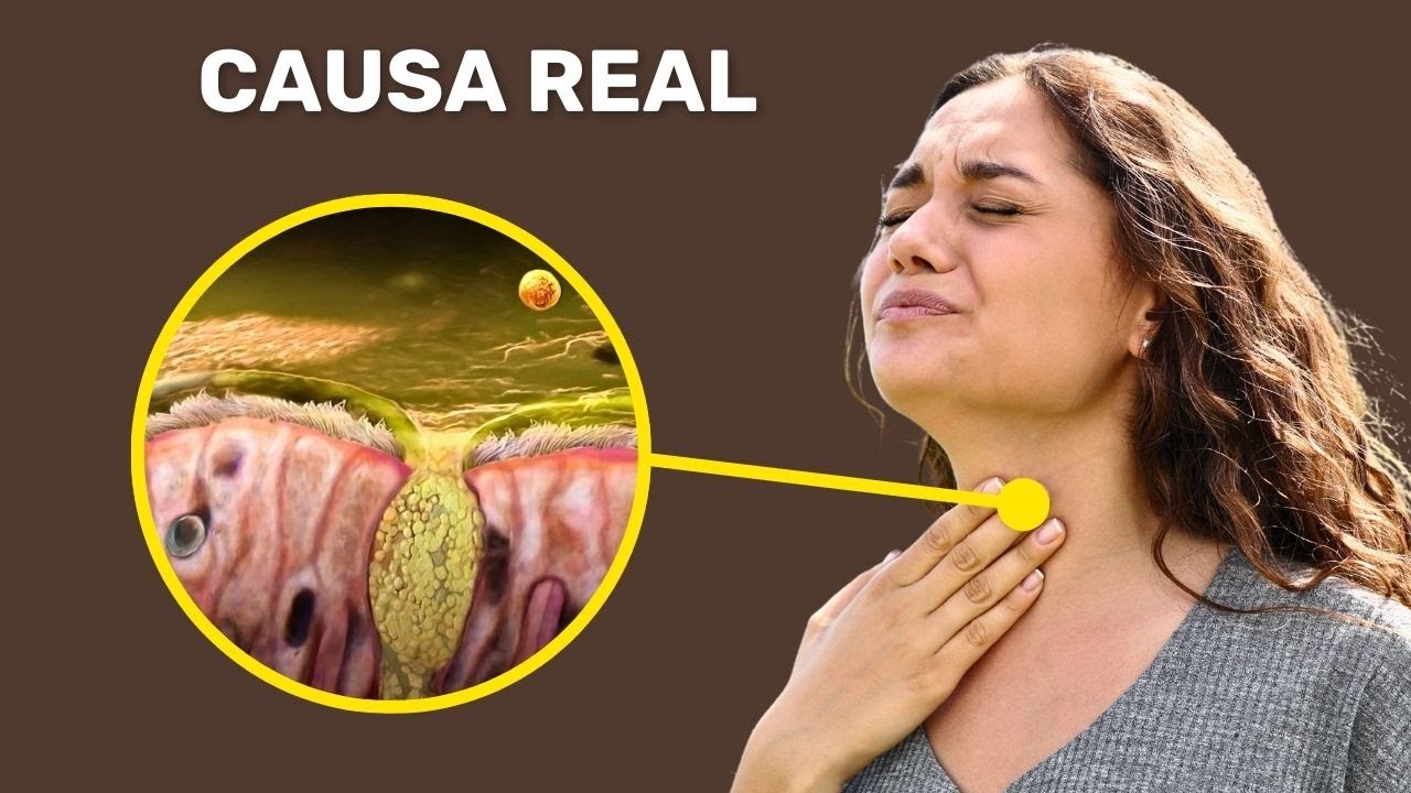 A Verdadeira Razão por Trás do Muco Incessante na Sua Garganta