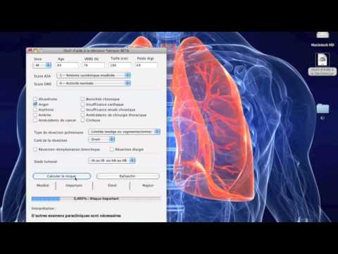comment soigner oedeme pulmonaire