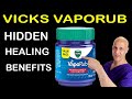 Everyone Knows Vick S VapoRub For Colds But Almost Nobody Knows This Secret Dr Mandell