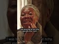 This Is What Skin Bleaching Products Do To Your Skin Over Time Skincare Healthcare The77percent
