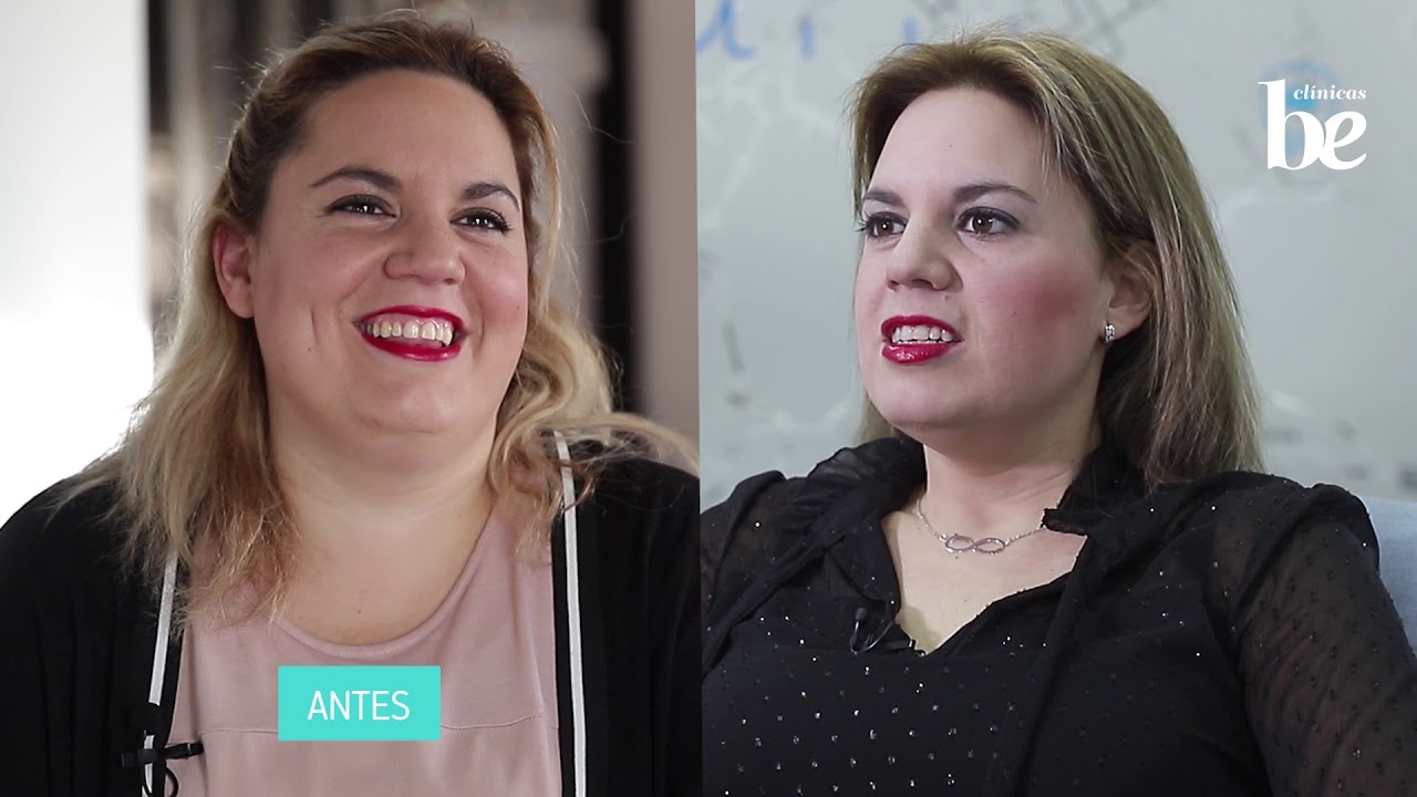 Perdí mucho peso con el nuevo Balón Intragástrico 1 año. Mi experiencia y resultados | Clínicas Be
