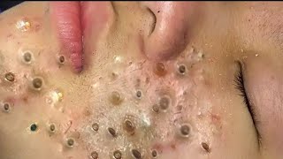دوافع التنظيف والتجميل #𝐁𝐥𝐚𝐜𝐤𝐡𝐞𝐚𝐝 𝐑𝐞𝐦𝐨𝐯𝐞 8641