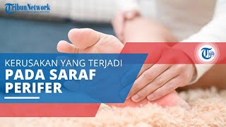 Neuropati Perifer, Kerusakan pada Saraf Perifer yang Menyebabkan Gejala Mati rasa dan Nyeri