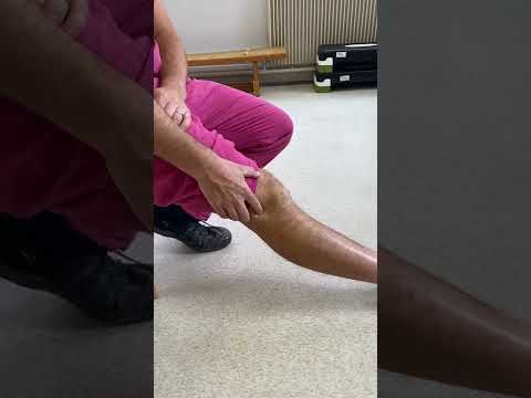 Lateral Collateral Ligament Sprain