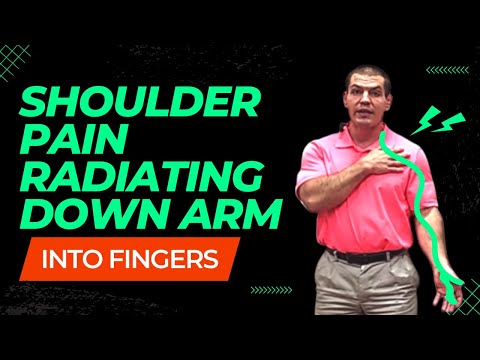 3 Causes Of Shoulder Pain Radiating Down Arm To Fingers (and What To Do About It)