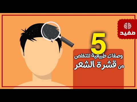 هل تريد التخلص منها ؟ 5 وصفات طبيعية للتخلص من قشرة الشعر ومنع ظهورها مجدداً