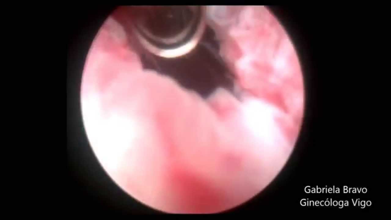 Gabriela Bravo Jaso-31