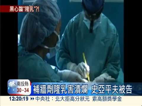 補牆劑隆乳害潰爛 史亞平夫遭訴