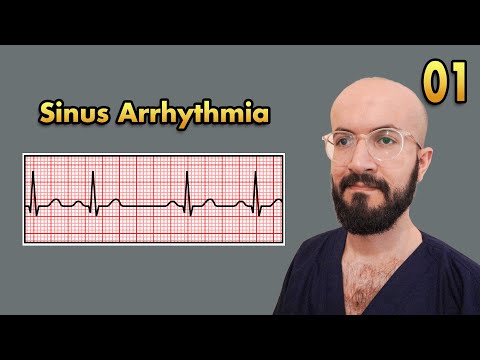 Sinus Arrhythmia: ECG Characteristics, Presentation & Treatment