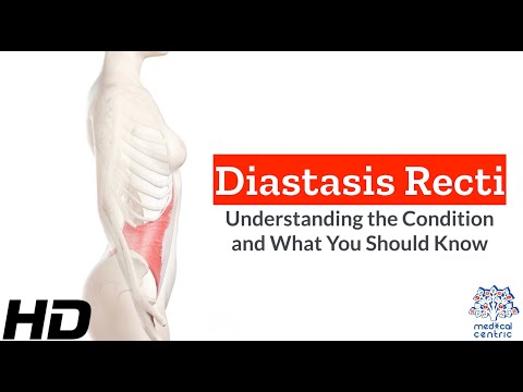 Frozen Shoulder Causes Signs and Symptoms Diagnosis and Treatment