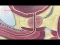 Prostate cancer: Essential facts - YouTube