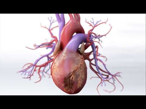 What is Coronary Artery Disease - Mechanism of Disease