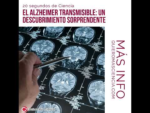 El Alzheimer transmisible un descubrimiento sorprendente #ciencia #sabiasesto #sabiasque