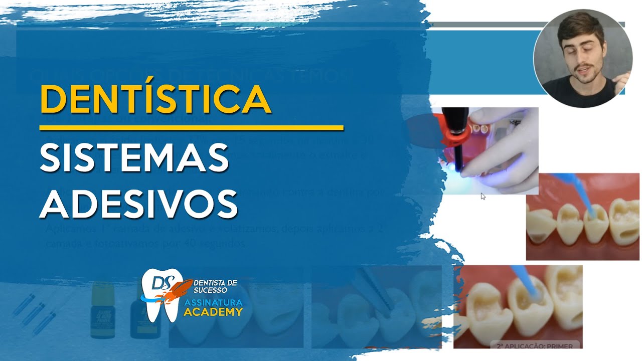 Sistemas adesivos | Dentística
