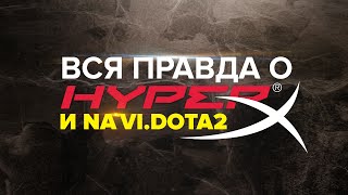 Вся правда о HyperX и Na`Vi.Dota 2