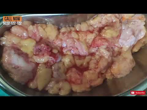 download lagu mp3 mp4 Sex Yadav, download lagu Sex Yadav gratis, unduh video klip Sex Yadav