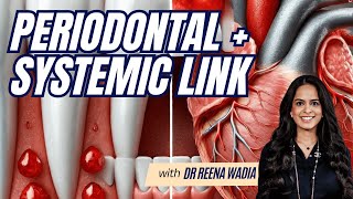 Periodontal and Systemic Link - Correlation or Causation? - GF024