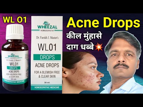 कील मुंहासे की दवा | Wheezal WL 1 Acne Drops | Acne Pimples Homeopathy Medicine! VNS HOMEOPATHY live