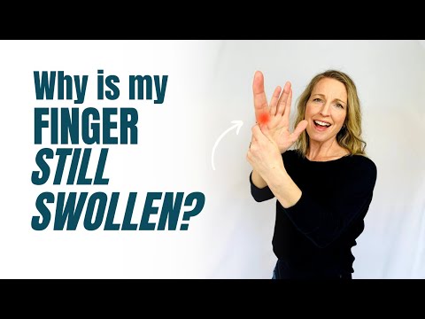 Why is My Finger Still Swollen?