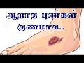 ஆறாத புண்கள் ஆற வேண்டுமா