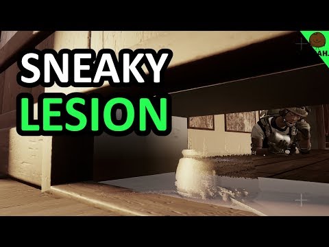 The YOLO Lesion Trick - Rainbow Six Siege