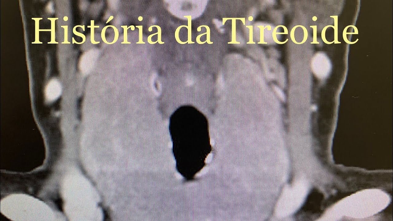 Giulianno Molina De Melo-71