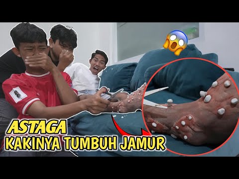 OH MY GOD, ARIK'S FEET HAVE GROWN OUT OF HER FOOT, DOES IT NEED TO BE CUPPED??😱 | Mikael TubeHD