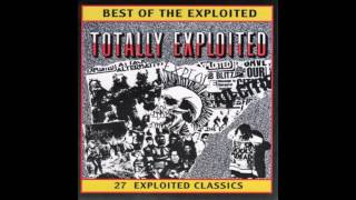 Download lagu The Exploited - Totally Exploited (1986) mp3 Download lagu The Exploited - Totally Exploited (1986) mp3