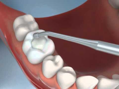 Single Video thumbnail