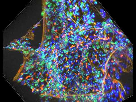 PLISH In situ hybridization of thick human lung tissue For SFTPC, MIR29-1, and AXIN2