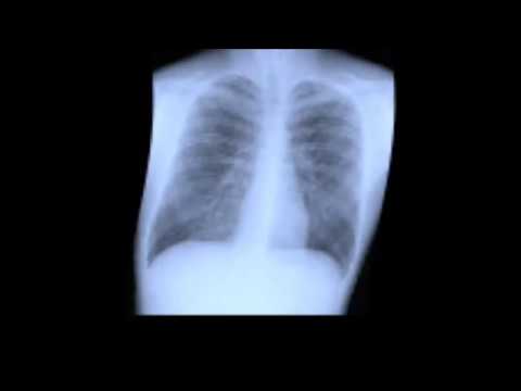 ACID view - Hitech trance