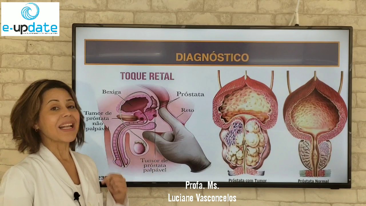 NOVEMBRO AZUL - O QUE É CÂNCER DE PRÓSTATA? / E-UPDATE CURSOS - Profª Ms. Luciane Vasconcelos