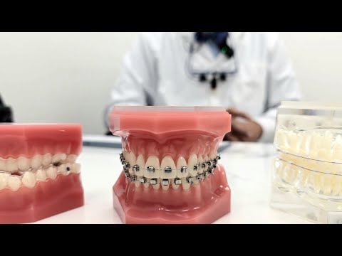 Invisalign or Braces, Which one is right for me or my child? | A Talk with Dr. Mosery