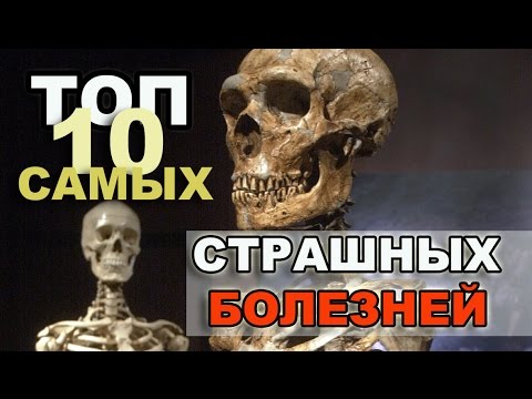 ТОП 10  САМЫЕ СТРАШНЫЕ БОЛЕЗНИ человечества ШОК!