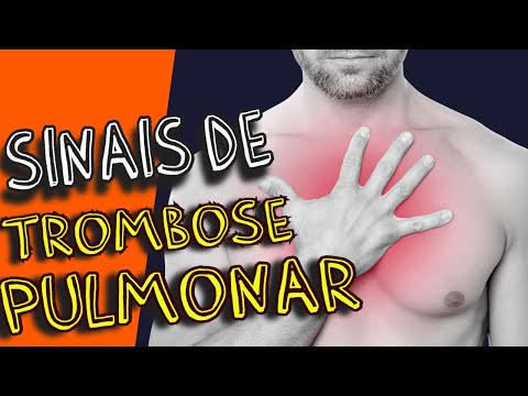 Pulmonary thrombosis: the ignored symptoms that could save your life.