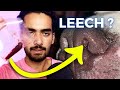 Leech Inside My Dog S Nose OUT In 1 STEP